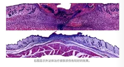 干细胞来源的外泌体治疗角膜、皮肤损伤